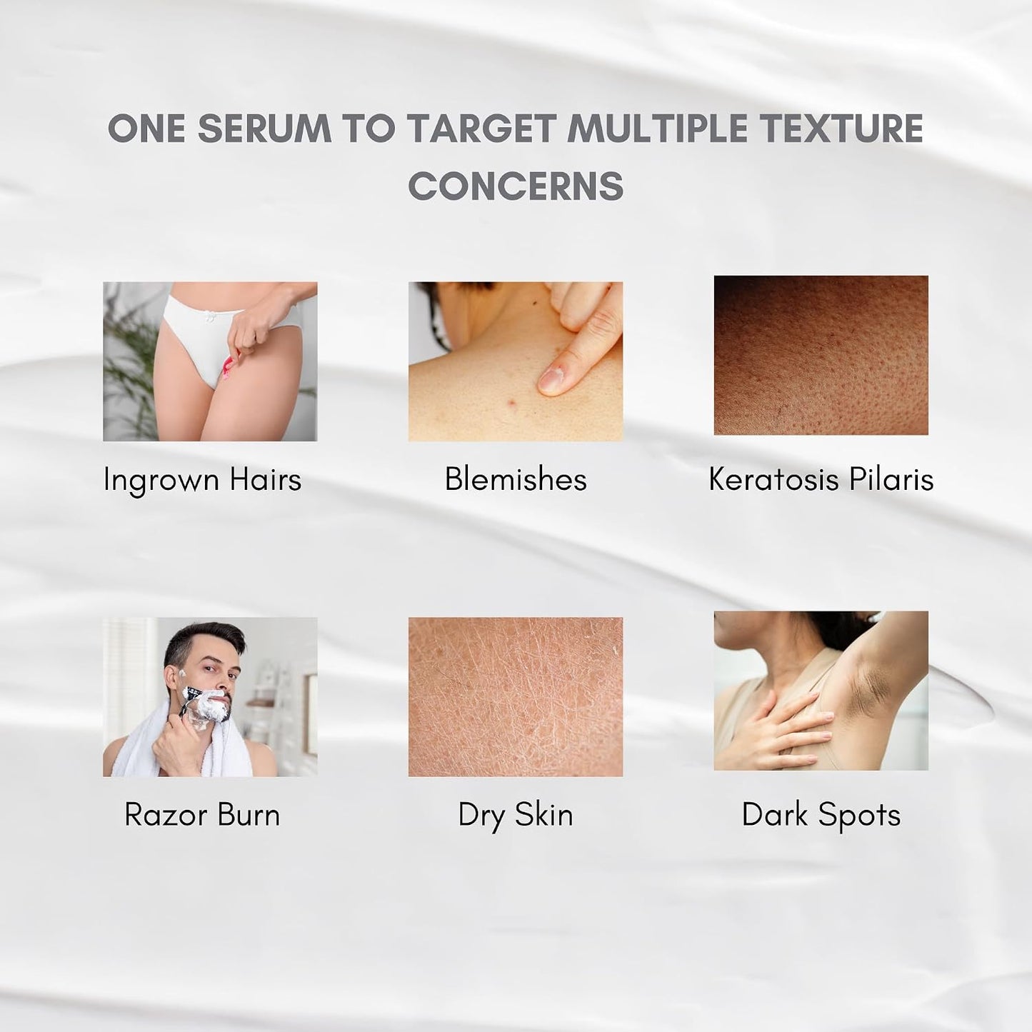 KP Treatment Body Serum (Triple Acid)