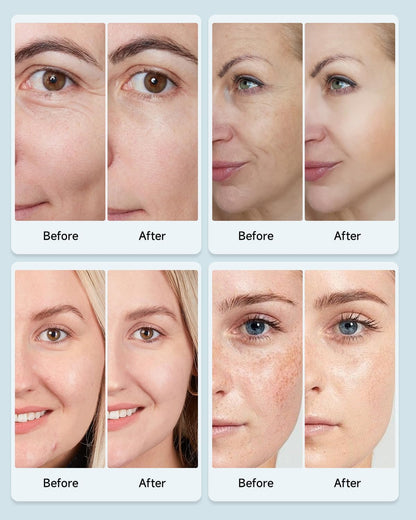 LED Red Light Therapy Face Mask
