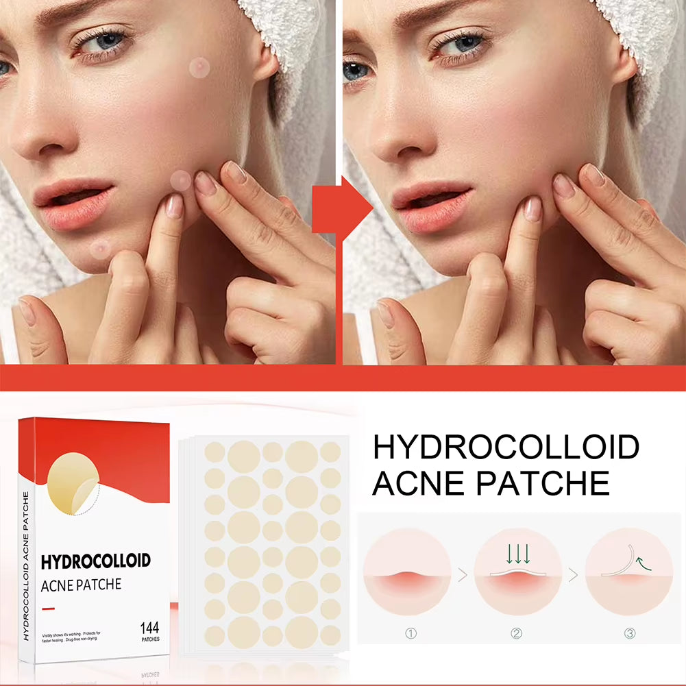 144Pcs/Set Face Skin Care Acne Pimple Patch 2 Sizes Invisible Professional Healing Absorbing Spot Sticker Covering for Men Women