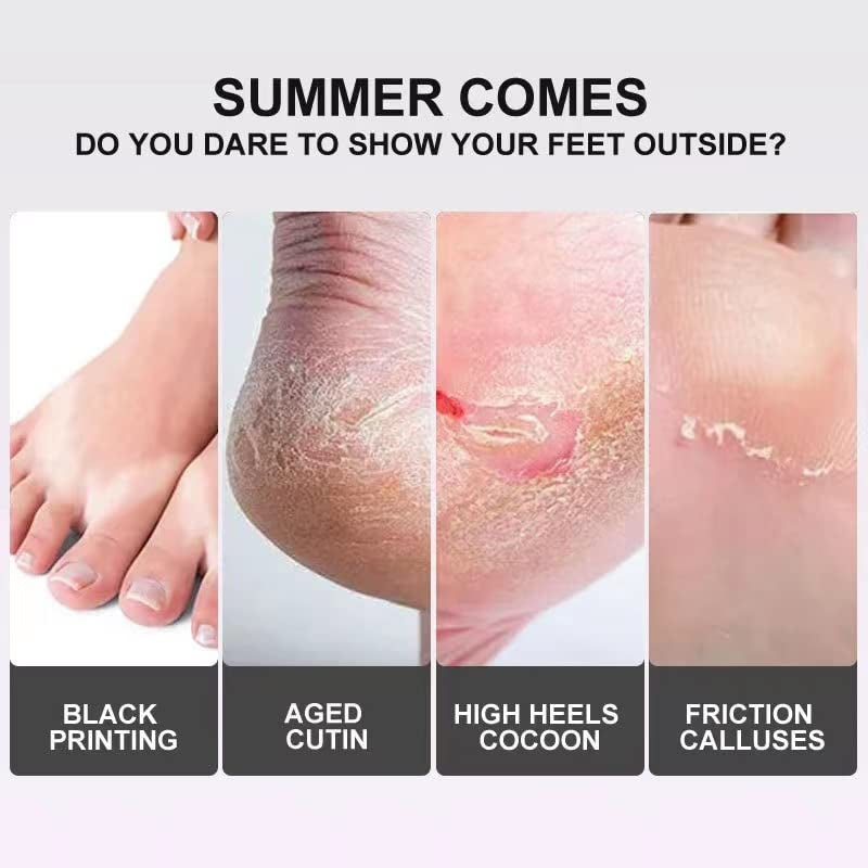 Foot Peel Mask (6-Pack)