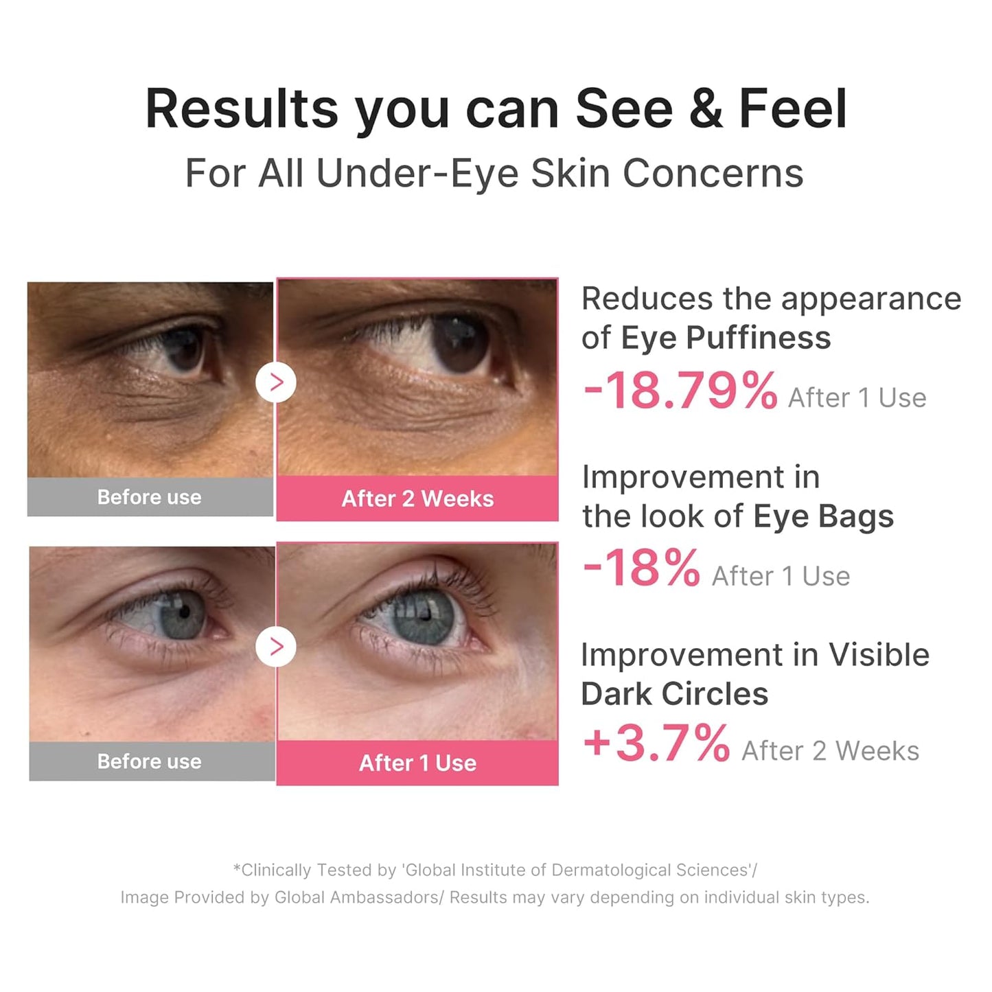Collagen PDRN Hydrogel Eye Patches (30 Pairs)