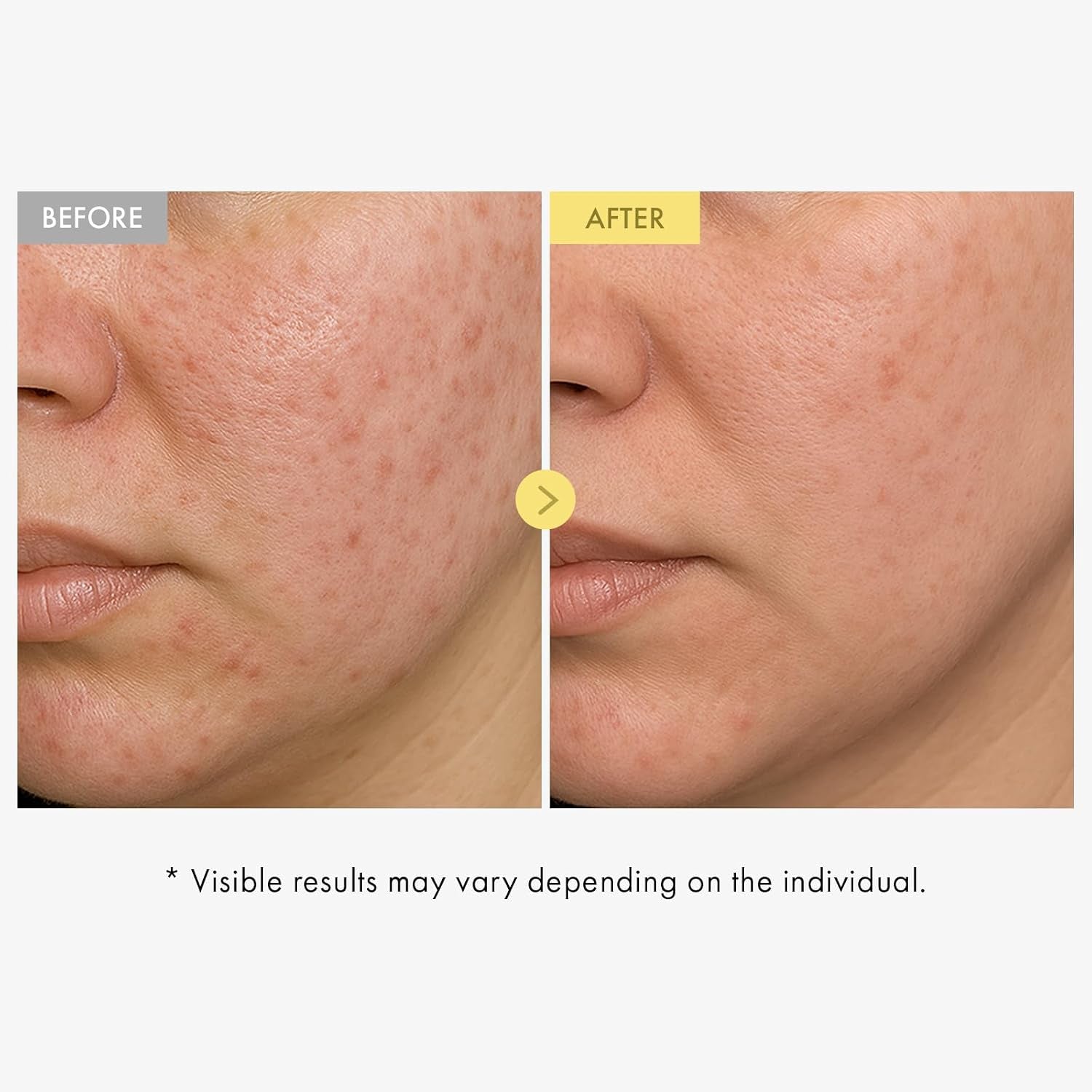 Propolis + Niacinamide Glow Serum