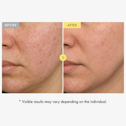 Propolis + Niacinamide Glow Serum
